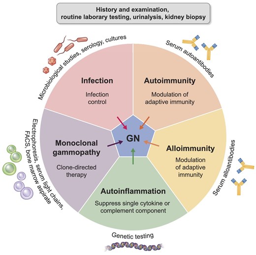 Originele figuur. Glomerulonefritis ingedeeld naar pathogene driver: infectie, auto-immuniteit, allo-immuniteit, auto-inflammatie en monoclonale gammopathie.
